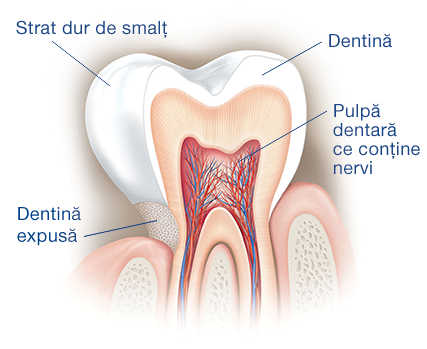 Ce cauzează sensibilitatea dentară? Ce cauzează sensibilitatea dentară?